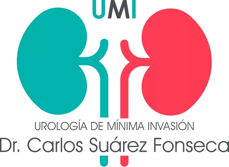 UMI, clínica de urología de mínima invasión en Madrid. UMI, clínica de urología de mínima invasión en Madrid.