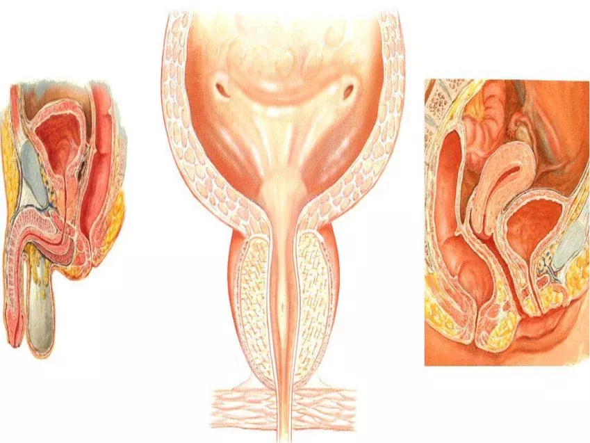 Información sobre cáncer de vejiga en el ámbito de la urología oncológica.