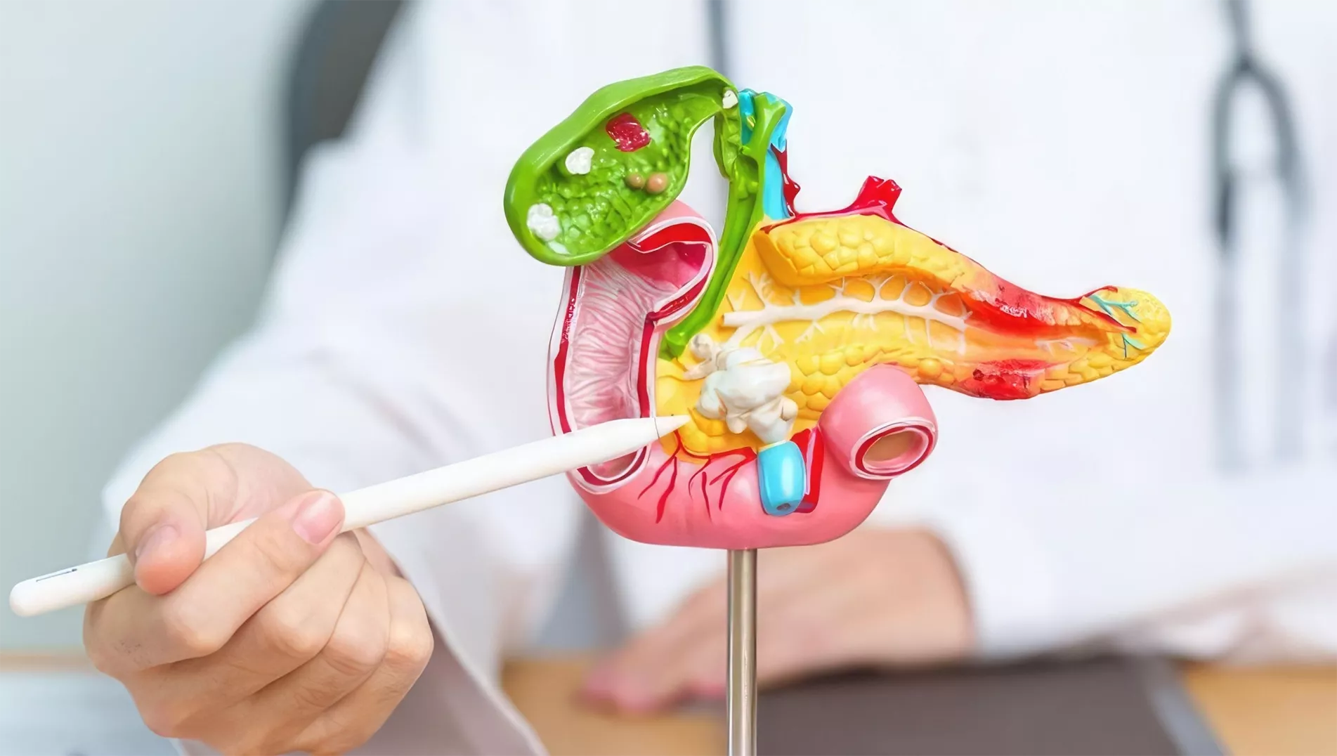 Información sobre litiasis urinaria en el ámbito urológico.