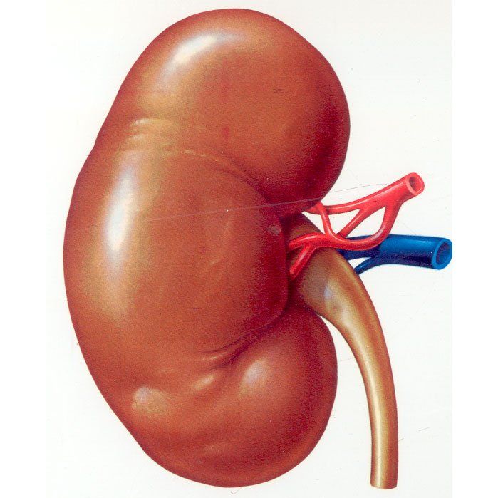 Cáncer de riñón Cáncer de riñón