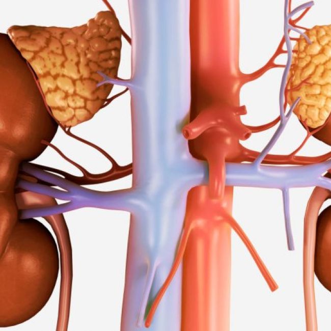 Tumor de glándula suprarrenal