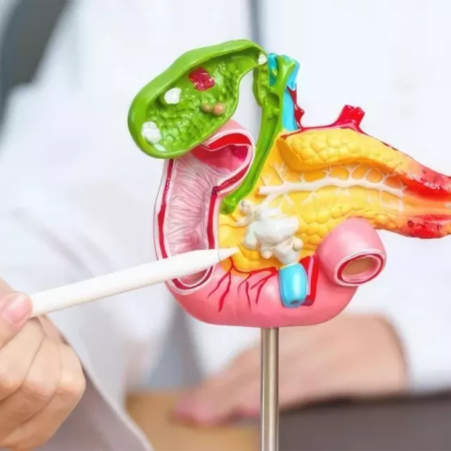 Información sobre litiasis urinaria en el ámbito urológico.