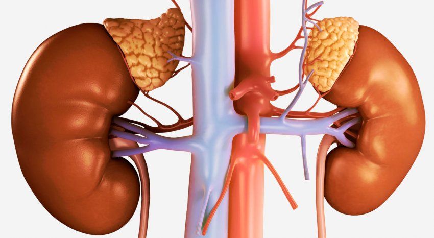 Tumor de glándula suprarrenal Tumor de glándula suprarrenal