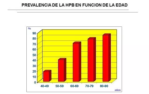 HPB en consultas de urología Información sobre hiperplasia prostática benigna y atención urológica especializada