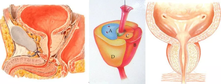Tratamiento de la hiperplasia prostática benigna Información sobre diagnóstico y tratamiento de la hiperplasia prostática benigna en Madrid